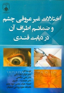 اختلالات غیرعروقی چشم و ضمایم اطراف آن در دیابت قندی