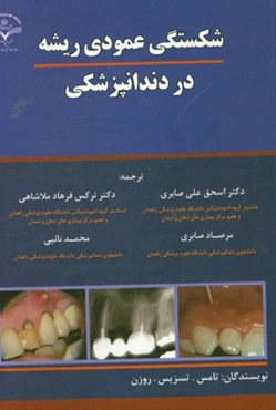 شکستگی عمودی ریشه در دندانپزشکی