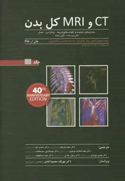 ‏‫CT و MRI کل بدن هاگا: بیماری‌های دمیلینه و لکوانسفالوپاتی‌ها - پانکراس - طحال...