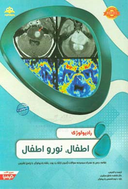 رادیولوژی: اطفال، نورواطفال: مجموعه سوالات آزمون ارتقاء و بورد رادیولوژی با پاسخ تشریحی Brant 2012 کتاب آمادگی آزمون ارتقاء و بورد 97