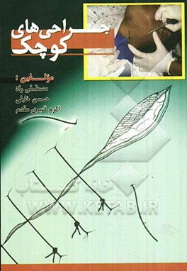 جراحی‌های کوچک