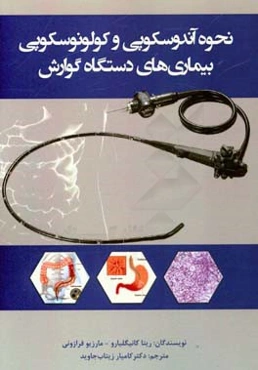 نحوه آندوسکوپی و کولونوسکوپی بیماری‌های دستگاه گوارش