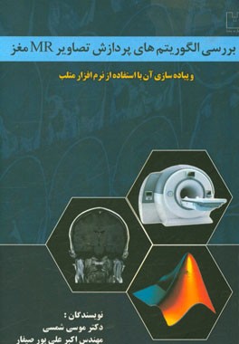 بررسی الگوریتم‌های پردازش تصاویر MR مغز و پیاده‌سازی آن با استفاده از نرم‌افزار متلب