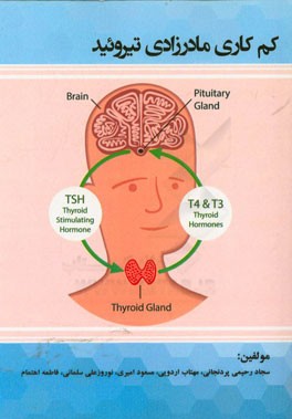 کم‌‌کاری مادرزادی تیروئید (Hypothyroidisl)