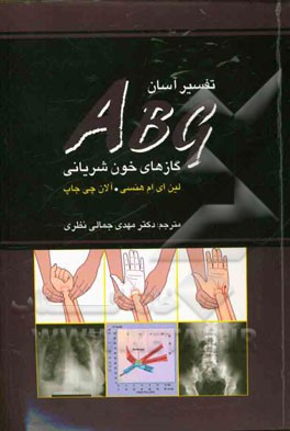 تفسیر آسان ABG گازهای خونی شریانی