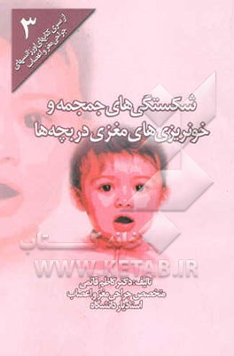 شکستگی‌های جمجمه و خونریزی‌های مغزی در بچه‌ها