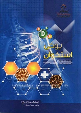 پوکی استخوان (پیشگیری تا درمان)