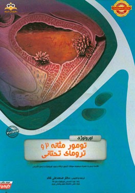 اورولوژی: تومور مثانه 2 ترومای تحتانی: خلاصه درس به همراه مجموعه سوالات ازمون ارتقاء و بورد اورولوژی با پاسخ تشریحیCampbell 2016 کتاب آمادگی آزمون ارت