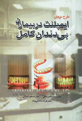 درمان ایمپلنت در بیماران بی‌دندان کامل