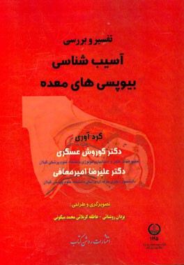 تفسیر و بررسی آسیب‌شناسی بیوپسی‌های معده