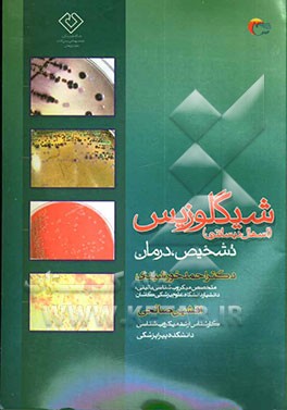 شیگلوزیس: تشخیص، درمان