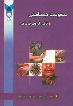 مسمومیت هیستامینی ناشی از مصرف ماهی