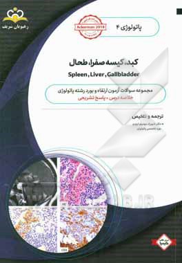 پاتولوژی: کبد، کیسه صفرا، طحال = Spleen, Liver, Gallbladder: خلاصه درس به همراه مجموعه سوالات آزمون ارتقاء و بورد پاتولوژی با پاسخ تشریحی ...