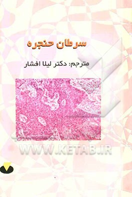 لارنکس و هیپوفارنکس: سرطان حنجره