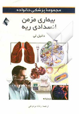 بیماری مزمن انسدادی ریه