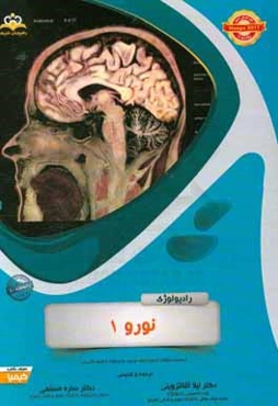 رادیولوژی: نورو 1: خلاصه درس به همراه مجموعه سوالات آزمون ارتقاء و بورد رادیولوژی با پاسخ تشریحی ...