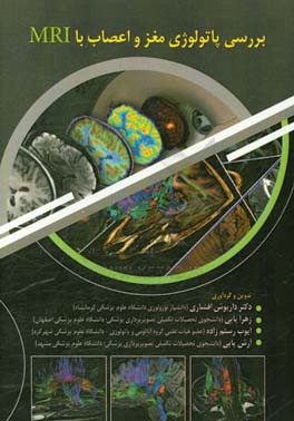 بررسی پاتولوژی مغز و اعصاب با MRI