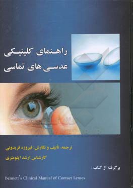 راهنمای کلینیکی عدسی‌های تماسی