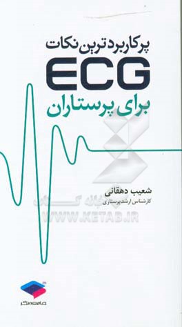 پرکاربردترین نکات ECG برای پرستاران