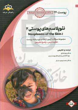 پوست: نئوپلاسم‌های پوستی‏‫ 2: خلاصه درس به همراه مجموعه سوالات آزمون ارتقاء و بورد پوست با پاسخ تشریحی Bolognia Dermatology 2012: کتاب آمادگی آزمون