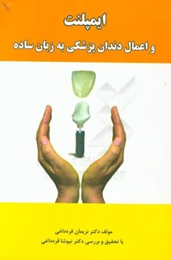 ایمپلنت و اعمال دندان‌پزشکی به زبان ساده