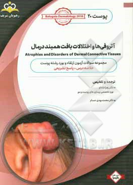 پوست: آتروفی‌ها و اختلالات بافت همبند درمال: خلاصه درس به همراه مجموعه سوالات آزمون ارتقاء و بورد پوست با پاسخ تشریحی