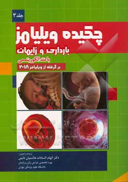 چکیده بارداری و زایمان ویلیامز با متد الگوریتمی