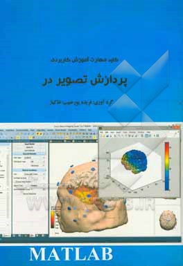 کلید مهارت آموزش کاربردی پردازش تصویر در MATLAB
