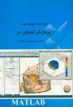 کلید مهارت آموزش کاربردی پردازش تصویر در MATLAB