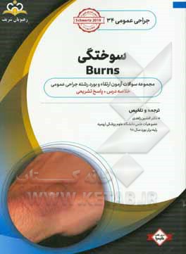جراحی عمومی: سوختگی: خلاصه درس به همراه مجموعه سوالات آزمون ارتقاء و بورد جراحی عمومی با پاسخ تشریحی