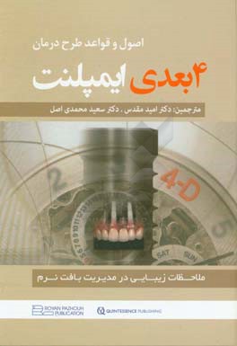 اصول و قواعد طرح درمان 4 بعدی ایمپلنت