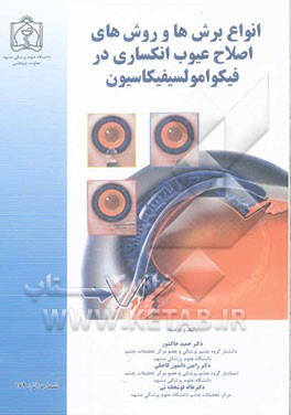 انواع برش‌ها و روش‌های اصلاح عیوب انکساری در فیکوامولسیفیکاسیون