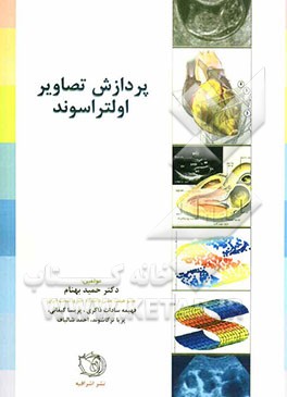 پردازش تصاویر اولتراسوند