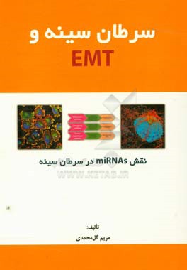 سرطان سینه و EMT: نقش Misnas در سرطان سینه