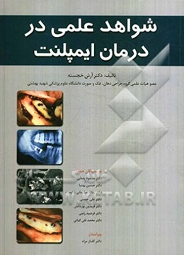 شواهد علمی در درمان ایمپلنت