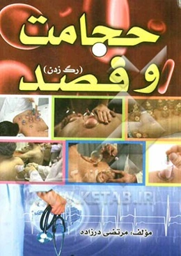 حجامت و فصد (رگ زدن)