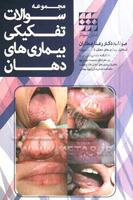 مجموعه سوالات تفکیکی بیماری‌های دهان