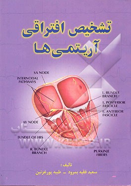 تشخیص افتراقی آرتیمی‌ها