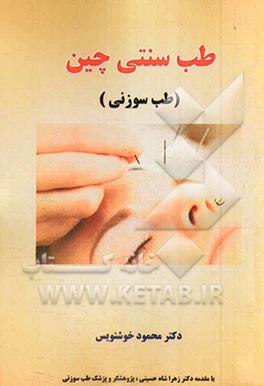 طب سنتی چین (طب سوزنی)