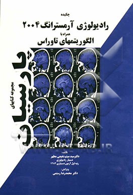 چکیده رادیولوژی آرمسترانگ 2004 همراه با الگوریتمهای انتخابی تاوراس