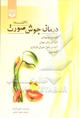 درمان جوش صورت (آکنه)