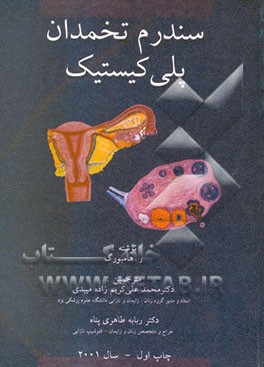 سندرم تخمدان پلی‌کیستیک