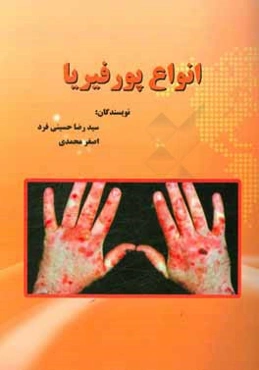 انواع پورفیریا