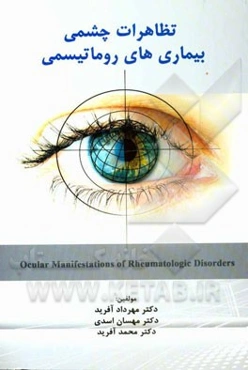 تظاهرات چشمی بیماری‌های روماتیسمی = Ocular manifestations of rheumatologic disorders