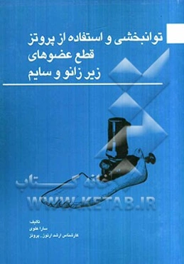 توانبخشی و استفاده از پروتز قطع عضوهای زیرزانو و سایم