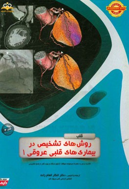 قلب: روش‌های تشخیص در بیماری‌های قلبی عروقی 1: خلاصه درس به همراه مجموعه سوالات آزمون ارتقاء و بورد قلب با پاسخ تشریحی ...