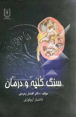 سنگ کلیه و درمان