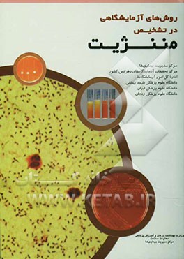 روش‌های آزمایشگاهی در تشخیص مننژیت