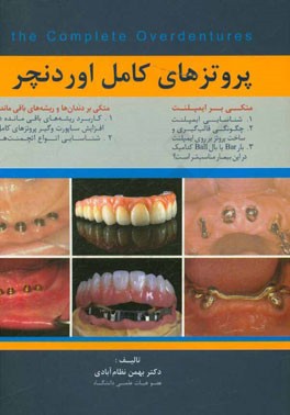 پروتزهای کامل اوردنچر = Complete over dentures supported by implants