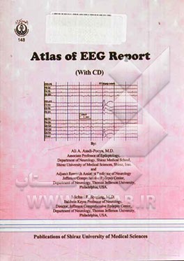 Atlas of Ictal EEG report (with CD)